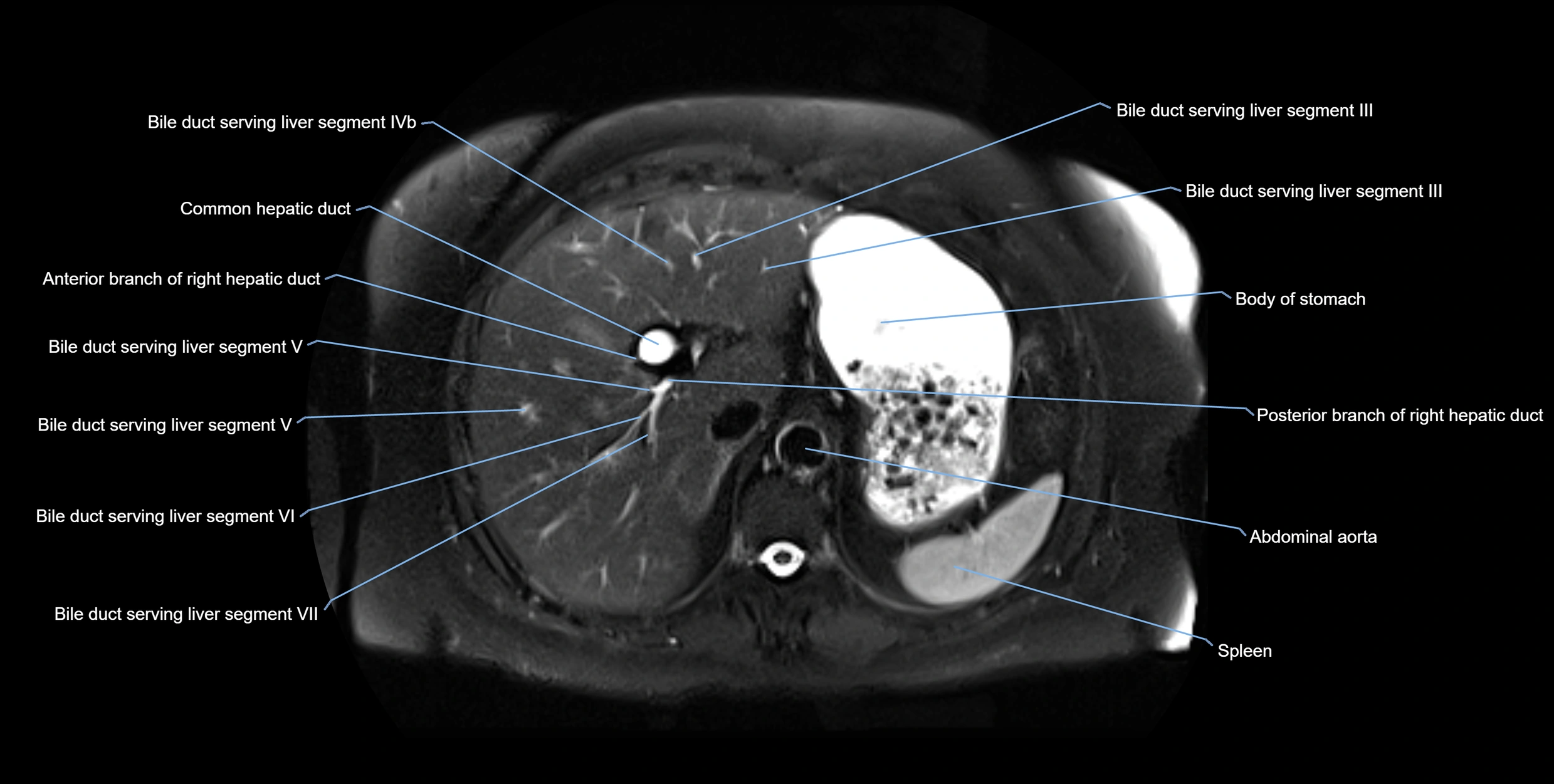 MRI MRCP axial cross sectional anatomy 3T radiology  image-img-10001-00015.webp